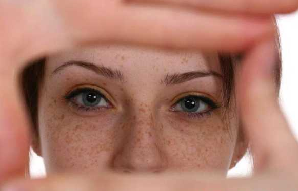青岛皮肤病医院#预防黄褐斑的6个方式，黄褐斑的形成原因