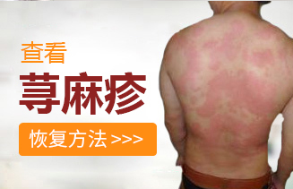 青岛市正规的皮肤科医院「排名公开」长荨麻疹是怎么回事